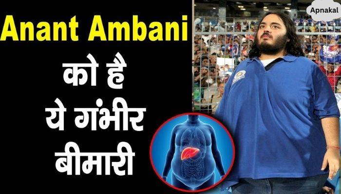 Anant Ambani is a victim of this serious disease, he himself told the whole truth