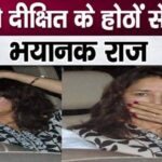 Madhuri Dixit's lips turned blue, this incident shocked everyone