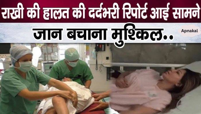 Big order from doctors to save Rakhi Sawant alive