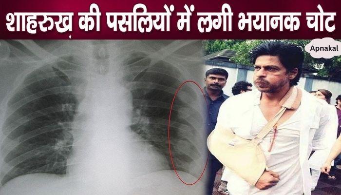 Horrific revelation related to Shahrukh Khan's rib injury in hospital