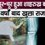 Shahrukh Khan's knee is ruined due to wear and tear, condition will make you cry