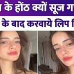 Ananya Pandey changed her face after breakup, got lip fillers done