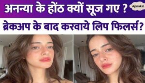 Ananya Pandey changed her face after breakup, got lip fillers done