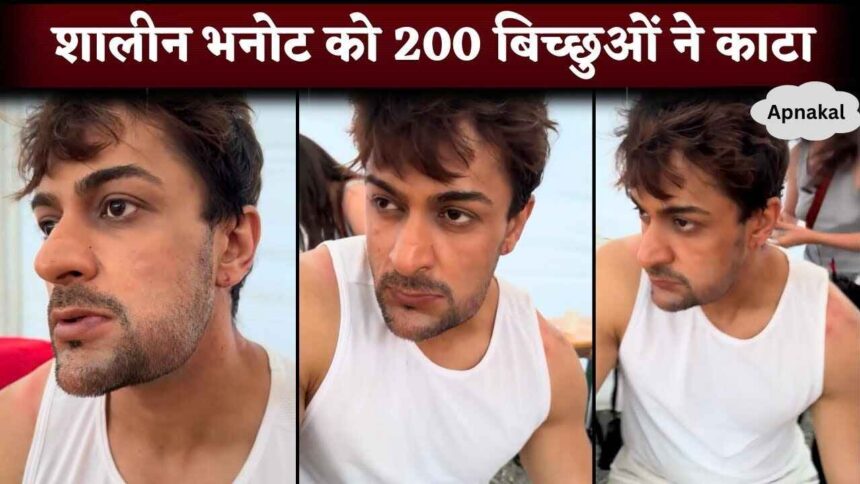 Shalin Bhanot Bitten By 200 Scorpions in Khatron Ke Khiladi 14 While Performing Stunt