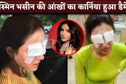 Actress Jasmin Bhasin Lost Eye Vision After Cornea Got Damaged Because Of Lenses