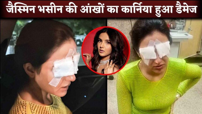 Actress Jasmin Bhasin Lost Eye Vision After Cornea Got Damaged Because Of Lenses