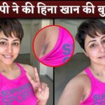 Hina Khan Embraces Her Cancer Chemotherapy Scars