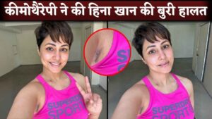 Hina Khan Embraces Her Cancer Chemotherapy Scars