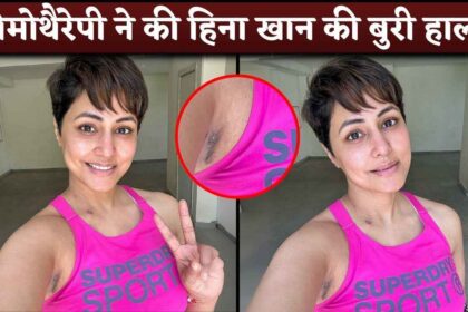 Hina Khan Embraces Her Cancer Chemotherapy Scars