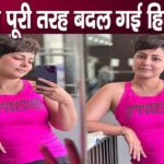 Hina Khan's transformation due to baldness amid cancer treatment