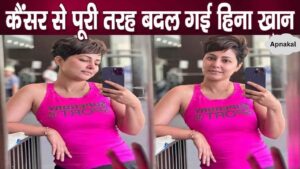 Hina Khan's transformation due to baldness amid cancer treatment