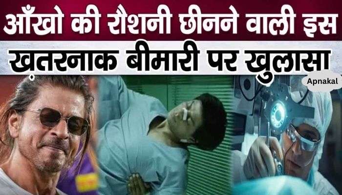 This eye disease of Shahrukh Khan is so serious, he may lose his vision