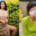 Jasmine Bhasin Break into Tears after Share Her Badly Experience Eye Problem