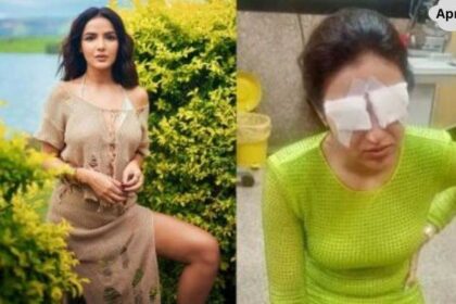 Jasmine Bhasin Break into Tears after Share Her Badly Experience Eye Problem