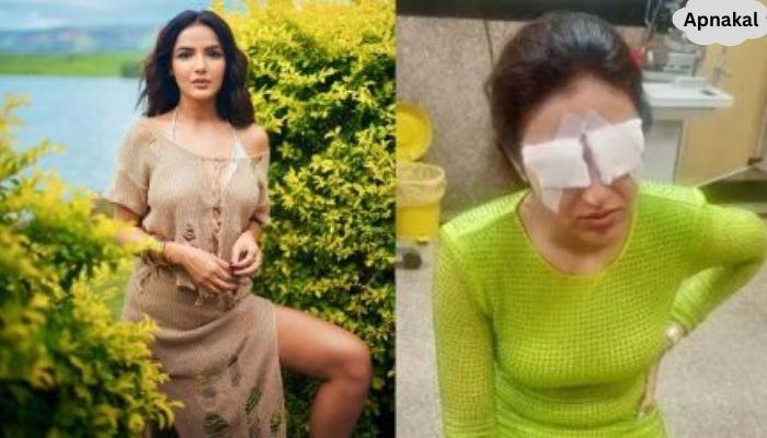 Jasmine Bhasin Break into Tears after Share Her Badly Experience Eye Problem