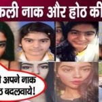 Khushi Kapoor approves plastic surgery on her face