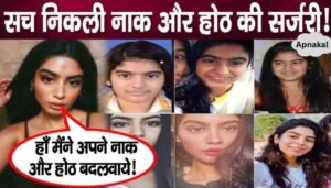 Khushi Kapoor approves plastic surgery on her face