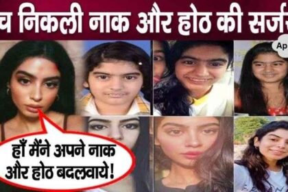 Khushi Kapoor approves plastic surgery on her face