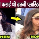 Sridevi used to undergo such cosmetic surgery to remove aging face