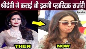 Sridevi used to undergo such cosmetic surgery to remove aging face