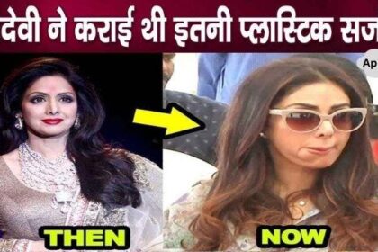 Sridevi used to undergo such cosmetic surgery to remove aging face