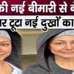 After cancer, revelations about this new painful disease of Hina Khan's mouth