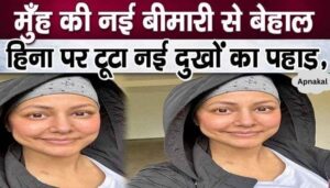 After cancer, revelations about this new painful disease of Hina Khan's mouth