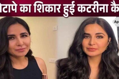 Katrina Kaif, who is suffering from obesity, expressed her pain about her face