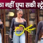 Stretch mark clearly visible on Malaika Arora's stomach, this condition happened due to cesarean delivery