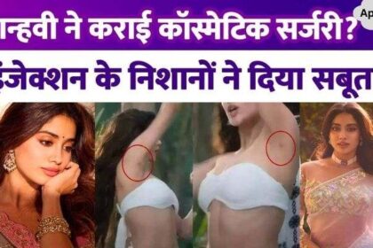 Did Jhanvi Kapoor undergo painful cosmetic surgery at the age of 27 The marks gave proof