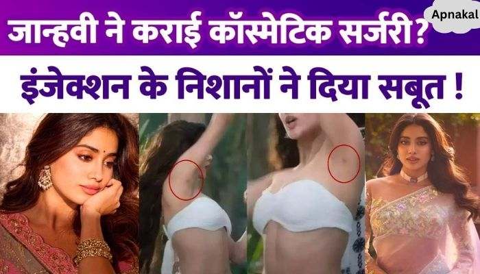 Did Jhanvi Kapoor undergo painful cosmetic surgery at the age of 27 The marks gave proof